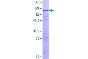 Image no. 1 for V-Ets Erythroblastosis Virus E26 Oncogene Homolog 2 (ETS2) (AA 1-469) protein (GST tag) (ABIN1353171)