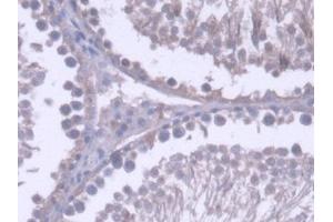 DAB staining on IHC-P; Samples: Rat Testis Tissue (RNASEH2A anticorps  (AA 1-301))
