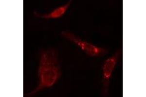 ABIN6275791 staining  HuvEc cells by IF/ICC. (TUBA3C/E anticorps)