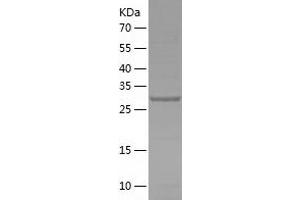 Western Blotting (WB) image for SplA/ryanodine Receptor Domain and SOCS Box Containing 2 (SPSB2) (AA 1-263) protein (His-IF2DI Tag) (ABIN7125194)