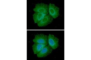 ICC/IF analysis of Adiponectin in Hep3B cells line, stained with DAPI (Blue) for nucleus staining and monoclonal anti-human Adiponectin antibody (1:100) with goat anti-mouse IgG-Alexa fluor 488 conjugate (Green). (ADIPOQ anticorps)
