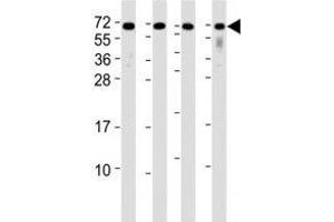 Western blot testing of CD63 antibody at 1:2000 dilution.