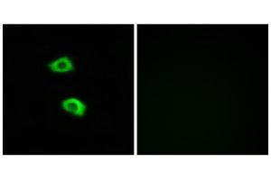 Immunofluorescence analysis of LOVO cells, using OR51B5 antibody. (OR51B5 anticorps  (Internal Region))
