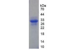 SDS-PAGE analysis of Human XPG Protein. (ERCC5 Protéine)
