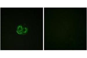 Immunofluorescence analysis of HuvEc cells, using Actin-pan ( alpha/gamma)  (Ab-55/53) Antibody. (Actin anticorps  (AA 21-70))