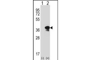 Western blot analysis of STX3 (arrow) using rabbit polyclonal STX3 Antibody (Center) (ABIN389321 and ABIN2839439). (STX3 anticorps  (AA 178-205))