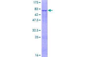 Image no. 1 for Solute Carrier Family 25 (Mitochondrial Carrier, Phosphate Carrier), Member 25 (SLC25A25) (AA 1-469) protein (GST tag) (ABIN1320275)