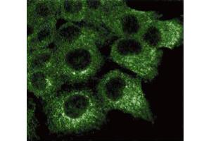 Immunofluorescence staining of A431 cells (Human epithelial carcinoma, ATCC CRL-1555).