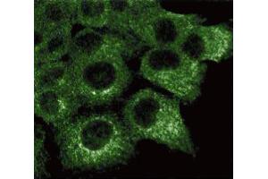 Immunofluorescence staining of A431 cells (Human epithelial carcinoma, ATCC CRL-1555). (HSPA4 anticorps  (AA 703-858))