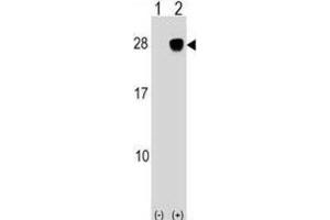 Western Blotting (WB) image for anti-UL16 Binding Protein 2 (ULBP2) antibody (ABIN2999200) (ULBP2 anticorps)
