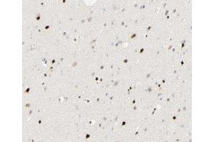 ABIN6266895 at 1/100 staining human brain tissue sections by IHC-P. (FOXJ3 anticorps  (C-Term))