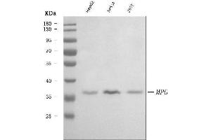 Western blot analysis of AAG/MPG using anti-AAG/MPG antibody (ABIN7600539).