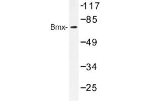 Image no. 1 for anti-BMX Non-Receptor Tyrosine Kinase (BMX) antibody (ABIN317608) (BMX anticorps)