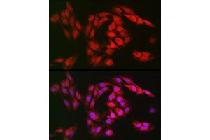 Immunofluorescence analysis of U2OS cells using SOD1 Rabbit pAb (ABIN3020854, ABIN3020855, ABIN3020856 and ABIN6213758) at dilution of 1:150 (40x lens). (SOD1 anticorps  (AA 1-154))