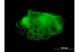 Immunofluorescence of monoclonal antibody to ATP2A1 on A-431 cell.