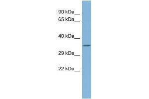 WB Suggested Anti-TTC35 Antibody Titration:  0. (TTC35 anticorps  (Middle Region))