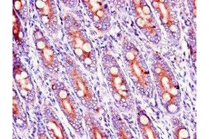 Immunohistochemistry of paraffin-embedded human small intestine tissue using ABIN7167318 at dilution of 1:100