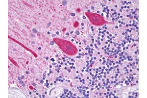 Anti-CES2 / Esterase antibody IHC of human brain, cerebellum, Purkinje cells. (CES2 anticorps  (C-Term))