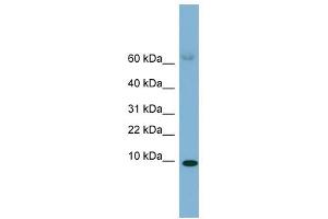 SAA4 antibody used at 1 ug/ml to detect target protein. (SAA4 anticorps  (Middle Region))