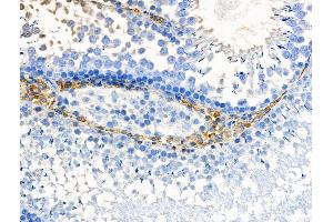 ABIN6257907 and ABIN6275041 at 1/100 staining Rat testis tissue by IHC-P.