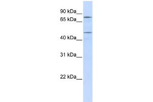 WB Suggested Anti-ERCC8 Antibody Titration: 0. (ERCC8 anticorps  (N-Term))