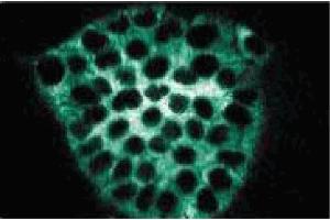 Immunofluorescence staining of A431 cells (Human epithelial carcinoma, ATCC CRL-1555).