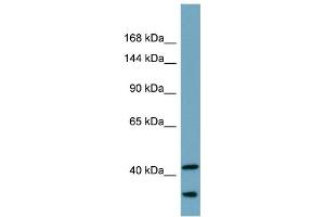 Host:  Rabbit  Target Name:  UBR2  Sample Type:  Fetal Small Intestine lysates  Antibody Dilution:  1. (UBR2 anticorps  (C-Term))