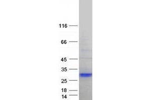 Validation with Western Blot
