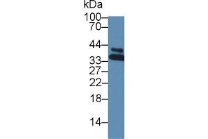 Western blot analysis of Mouse Small intestine lysate, using Mouse HNRPA1 Antibody (3 µg/ml) and HRP-conjugated Goat Anti-Rabbit antibody ( (HNRNPA1 anticorps  (AA 2-320))