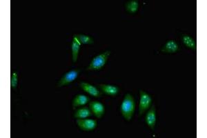 Immunofluorescent analysis of A549 cells using ABIN7176097 at dilution of 1:100 and Alexa Fluor 488-congugated AffiniPure Goat Anti-Rabbit IgG(H+L)