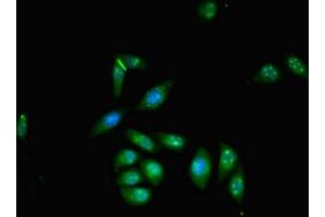 Immunofluorescent analysis of A549 cells using ABIN7176097 at dilution of 1:100 and Alexa Fluor 488-congugated AffiniPure Goat Anti-Rabbit IgG(H+L) (ZMYND11 anticorps  (AA 363-513))