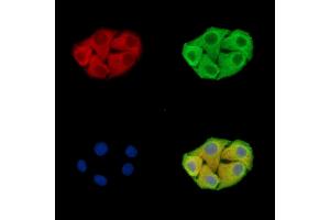 ABIN7096438 and ABIN7100502 staining Hela cells by IF/ICC. (GRAMD1B anticorps)