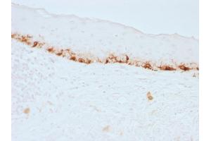 Formalin-fixed, paraffin-embedded human Skin stained with MART-1 Monoclonal Antibody (M2-7C10).