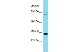 Western Blotting (WB) image for anti-Chromosome 4 Open Reading Frame 43 (C4orf43) (Middle Region) antibody (ABIN2791117) (C4orf43 anticorps  (Middle Region))