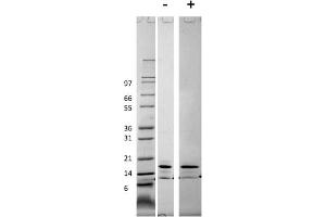 SDS-PAGE of Mouse Monocyte Chemotactic Protein-1 (CCL2) Recombinant Protein SDS-PAGE of Mouse Monocyte Chemotactic Protein-1 (CCL2) Recombinant Protein.