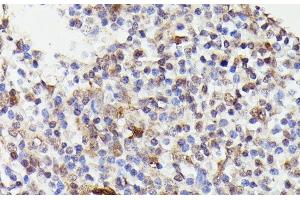 Immunohistochemistry of paraffin-embedded Human tonsil using CDC23 Polyclonal Antibody at dilution of 1:100 (40x lens). (CDC23 anticorps)