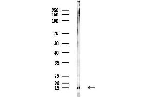 Western blot analysis of lysates from F10-LUC cells(UV,30 min treatment), using RPL35A Antibody at 1/1000 dilution.
