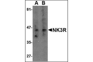 Western blot analysis of NK3R in RAW264. (TACR3 anticorps  (Center))