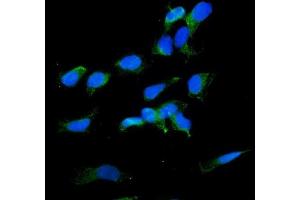 IF analysis of RDX using anti-RDX antibody (ABIN7602767).