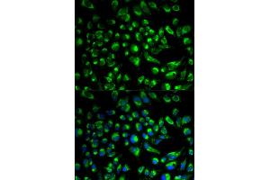 Immunofluorescence analysis of HeLa cells using SPAM1 antibody. (SPAM1 anticorps)