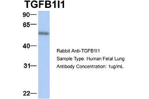 Host:  Rabbit  Target Name:  TGFB1I1  Sample Type:  Human Fetal Lung  Antibody Dilution:  1.