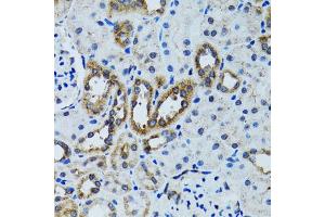 Immunohistochemistry of paraffin-embedded mouse kidney using RPN1 antibody. (RPN1 anticorps)