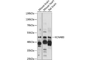 Western blot analysis of extracts of various cell lines, using KCN antibody (ABIN7269483) at 1:1000 dilution. (KCNAB3 anticorps  (AA 285-404))
