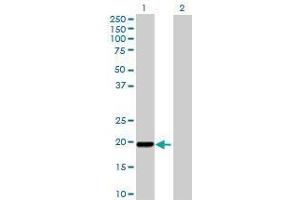 Lane 1: MSRB3 transfected lysate ( 20 KDa) Lane 2: Non-transfected lysate. (MSRB3 293T Cell Transient Overexpression Lysate(Denatured))