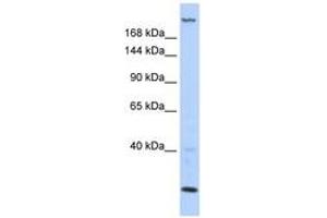 Image no. 1 for anti-Trinucleotide Repeat Containing 6B (TNRC6B) (AA 396-445) antibody (ABIN6743011) (TNRC6B anticorps  (AA 396-445))