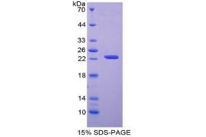 SDS-PAGE analysis of Human APRT Protein.