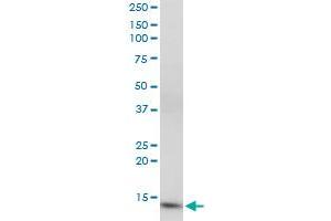 CIDEC monoclonal antibody (M07), clone 2E2. (CIDEC anticorps  (AA 53-141))