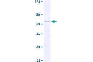 Image no. 1 for Zinc Finger Protein 322A (ZNF322A) (AA 1-402) protein (GST tag) (ABIN1326099)