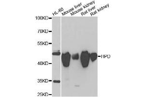 Western blot analysis of extracts of various cell lines, using HPD antibody. (HPD anticorps  (AA 1-393))