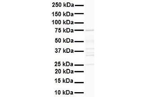 WB Suggested Anti-DDX41 antibody Titration: 1 ug/mL Sample Type: Human heart (DDX41 anticorps  (N-Term))